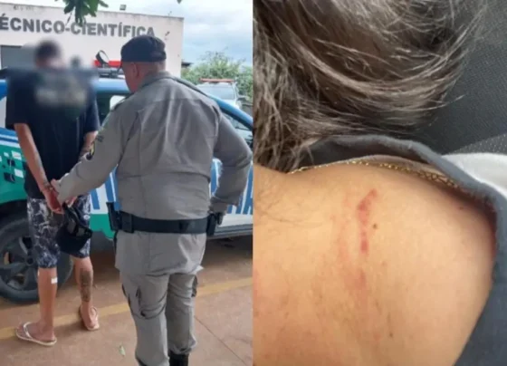 Motorista ficou com marcas no pescoço devido a agressão - (Foto: divulgação/PM)